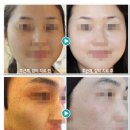 미성형피부과 Daum카페