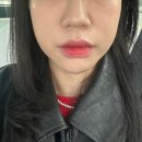 프라임여성의원건물 | 새봄여성의원 쿨페이즈 내돈내산 후기 (써마지 차이점)