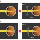 오목안경원 이미지