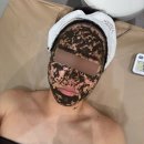 경기바이오 | [경기 광주] 엘덤에스테틱 :: 태전동 에스테틱 바이오리필 피부관리 후기