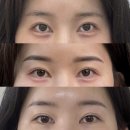 대덕대로-6 | 대전 눈썹문신 블랑슈 완벽한 내돈내산 후기