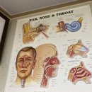 프라임보청기 이미지