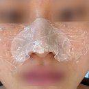 가림피부관리 | 창원중동에스테틱, 셀리닉 아기피부 광채관리 후기