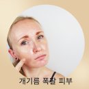 리나스킨케어