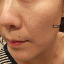 아오와 엘라줄렌 펩타블루 카밍앰플 후기 강추앰플!!