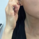 귀혈자리패치로 비염 나아졌어요, 셀비오 이어밸런스 후기