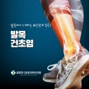 몸편한마취통증의학과의원 | 왜관읍마취통증의학과 발목통증, 발목 힘줄에 연증이 생긴 상태 '발목건초염'