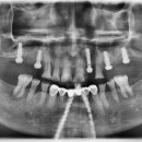 이(e)-밝은치과의원 이미지