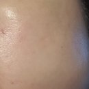 퍼스트메드 이미지