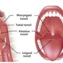 편도 부었을때 증상 및 약 원인 대처법 이미지