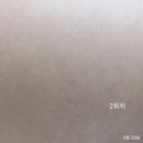 엘지보떼 | 튼살전문 보떼슈아 강남점 튼살 내돈내산 3회차 후기 | 전후 변화 공개