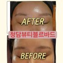 검생이의달 | 강남에스테틱 청담뷰티블르바드에서 받은 화이트닝 관리 후기 : 강남신부관리