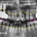 메디포레치과의원 이미지