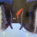 모멘텀헤어라인의원 이미지