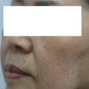 리프업의원 | 리프업의원 영업비밀 : 정보가 부족한 당신을 위해