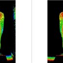 우리들척추운동센터 이미지