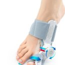 비엔피병원 | 하루 10분, 발 건강이 달라졌어요 비엔피메디컬 무지외반증 발가락교정기 실제 사용 후기!