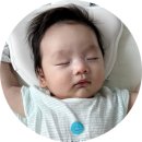 더블유성형외과의원 | 대구스킨텍병원 더블유병원(W병원) 신생아 100일 스킨텍(스킨택, 귀젖, 부이개) 수술 치료 후기