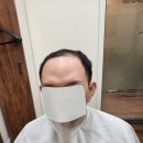 청량리가발 | [서울 당일가발] 단 2시간 만에 탈모 고민 해결! 서울 기성품 가발 49만원 합리적인 남자 기성가발