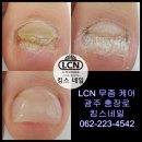 킴스케어시스템