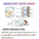 강남르시엘여성의원 | 자궁근종 수술 후기ㅣ복강경 강남르시엘병원 (수술~퇴원) 2편
