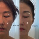 숨스킨앤바디 - 군산시 | [김해피부관리] 나만 알고 싶은 구산동에스테틱 '백퍼센트 스킨앤바디' 리프팅 탄력관리 후기