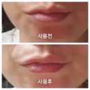 족도리강화점 | 본초 테라피 황련고 립밤 건조한 지금 영양과 함께 관리하세요
