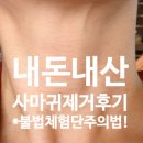 미가의료기미카페 | [일상/후기]내돈내산 사마귀, 쥐젖 300개 제거후기 * 미용불법체험단 주의하는 법!