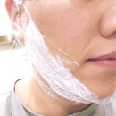 턱시 | 부산 투턱시술 추천 장산역피부과 스테로이드없는 윤곽주사 이중턱 관리 후기, 통증