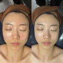 마곡역 효과 좋은 에스테틱샵 @아마릴리스뷰티 방문 후기