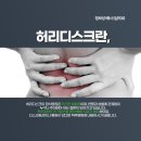 오늘도라면24 | 아산허리디스크 추천 병원 찾다가 진짜 잘됐다 싶었던 곳