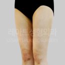 레아트성형외과의원 이미지