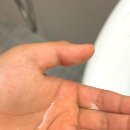 사춘기샴푸로 정수리 냄새 잡는 비법 공개
