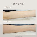[서면 왁싱] 팔찌 착용하려고 제모한 사람의 부산 더린뷰티 슈가링 팔왁싱 후기(털 많음 주의)