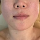 강남-216 | 강남역 피부과보다 웨딩관리 잘하는 이은주에스테틱 내돈내산 후기