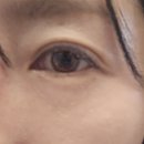 닥터멜락신 아이백크림 2개월 후 후기와 아쿠아 이온 플라즈마 크림 내돈내산