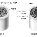 골다공증 이란? 이미지