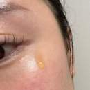 마미약국 | 마미케어 기미 잡티에는 오쏘타민앰플 브라리언 약국템 바르는 비타민C 앰플 잡티 화장품 솔직 후기