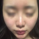 (주)뷰티큐앤에이 | 가정용 LDM 디바이스 뭐 사야할까 고민중 ㅣ 쿼드쎄라, UDM , 글로우엠 , 톰더글로우