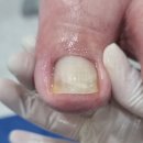 빛나러오소 문제성 발관리 계양구청점 이미지