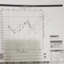 보청기 파손 새 보청기 선택 이미지