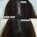 일산 장항동 가르마 두피커버 탈모 smp 오나뷰티 후기