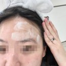 부천 신중동 인셀덤엔젤에서 인셀덤 체험 받고 피부 광채 폭발한 후기
