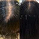 향남 두피관리전문점 H리셀 헤드스파테라피 받고온 솔직 후기