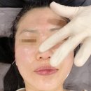 본클리닉피부과성형외과 네이버블로그