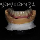 스마일라인치과기공소 이미지