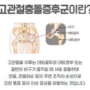 안산피티 맥스짐 | 러닝 후 고관절앞쪽 &amp; 아킬레스건 통증 재활피티 후기 [안산 고잔동pt]