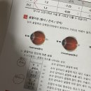 희망온누리약국 | 전주 온누리안과 고도근시 스마일라식 후기