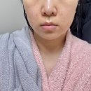 타임락튠 부작용 없는 튠페이스 내돈내산 후기!