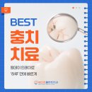 온치과기공소 | 상남동치과 충치 치료, 원데이 인레이로 하루 만에 끝낼 수 있을까?